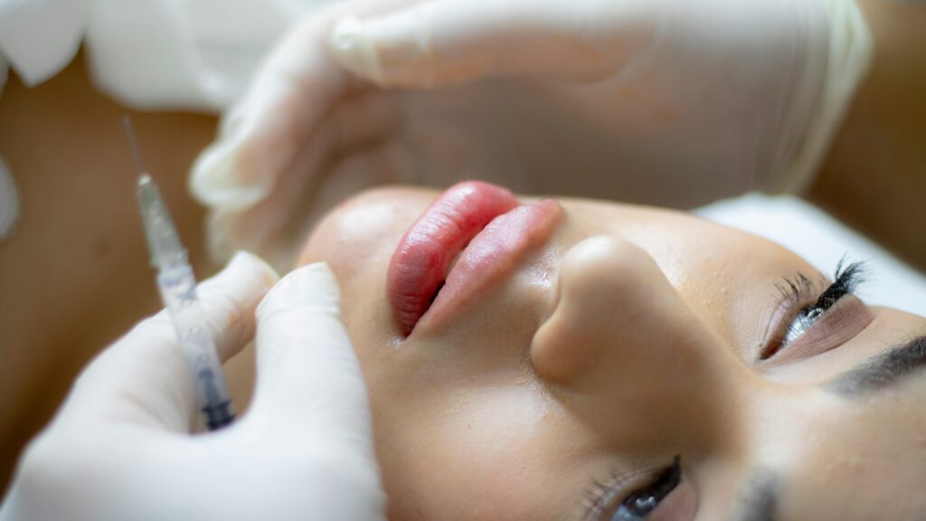 Aumento de labios - clinica estética